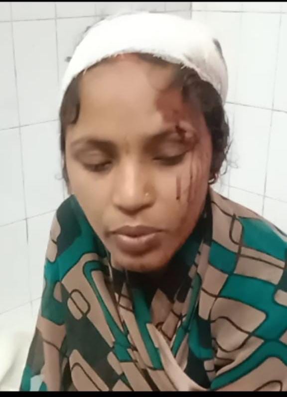 पुरानी रंजिश को लेकर दो पंक्षों में हुआ खूनी जंग…कई जख्मी